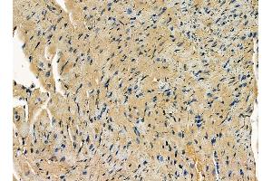 ABIN7095318 and ABIN7099375 at 1/100 staining mouse heart tissue by IHC-P. (SNX33 抗体)