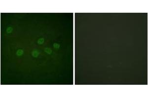 Immunofluorescence analysis of HeLa cells, using CBP (Ab-1535) Antibody. (CBP 抗体  (AA 1501-1550))