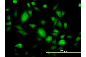 anti-Guanine Nucleotide Binding Protein (G Protein), beta Polypeptide 3 (GNB3) (AA 1-340) antibody