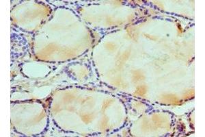 Immunohistochemistry of paraffin-embedded human thyroid tissue using ABIN7175761 at dilution of 1:100 (WDR5 抗体  (AA 1-334))