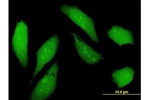 Immunofluorescence of purified MaxPab antibody to NSFL1C on HeLa cell. (NSFL1C 抗体  (AA 1-370))