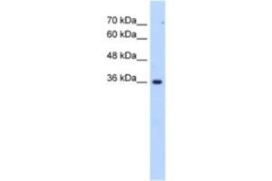 Western Blotting (WB) image for anti-Asparagine-Linked Glycosylation 1 Homolog Pseudogene (ALG1L6P) antibody (ABIN2463268) (ALG1L6P 抗体)