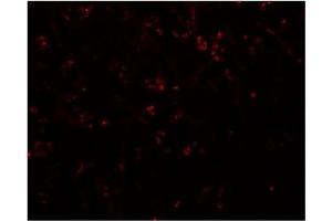Immunofluorescence of SYNPO in human brain tissue with SYNPO Antibody  at 20 μg/ml. (SYNPO 抗体  (C-Term))