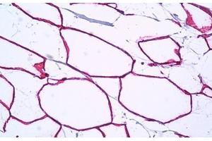 Anti-PTRF antibody IHC staining of human breast, adipocytes.