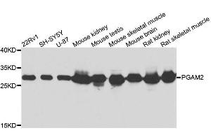 Western blot analysis of extracts of various cell lines, using PGAM2 antibody. (PGAM2 抗体  (AA 1-253))