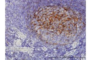 Immunoperoxidase of monoclonal antibody to QPRT on formalin-fixed paraffin-embedded human tonsil. (QPRT 抗体  (AA 198-297))