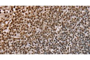 Immunohistochemistry of paraffin-embedded Human tonsil using NUP50 Polyclonal Antibody at dilution of 1:30 (NUP50 抗体)