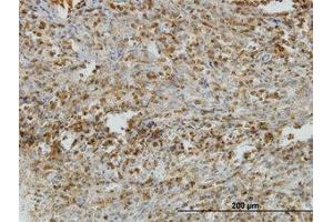 Image no. 1 for anti-Interleukin 31 Receptor A (IL31RA) (AA 21-121) antibody (ABIN599325) (IL31RA 抗体  (AA 21-121))