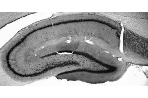 Adult rat hippocampus immunohistochemistry.