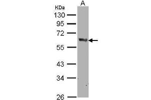 WB Image Sample(30 μg of whole cell lysate) A:MOLT4, 10% SDS PAGE antibody diluted at 1:500 (PTGS1 抗体  (C-Term))
