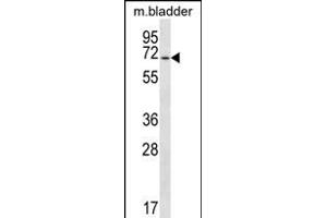 EYA1 Antibody (N-term) (ABIN656379 and ABIN2845674) western blot analysis in mouse bladder tissue lysates (35 μg/lane). (EYA1 抗体  (N-Term))
