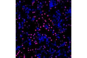 Immunofluorescence of paraffin embedded rat kidney using NPEPL1 (ABIN7073185) at dilution of 1:200 (300x lens) (BIVM 抗体)