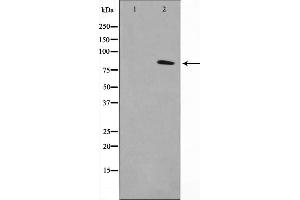 Western blot analysis on K562 cell lysate using TACC1 Antibody,The lane on the left is treated with the antigen-specific peptide.