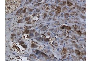 Formalin-fixed and paraffin embedded rat ovary labeled with Anti-CTBP1 Polyclonal Antibody, unconjugated (ABIN686152) followed by incubation with conjugated secondary antibody and DAB staining (CTBP1 抗体  (AA 351-440))