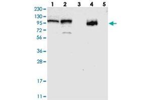 Western blot analysis of Lane 1: RT-4, Lane 2: U-251 MG, Lane 3: Human Plasma, Lane 4: Liver, Lane 5: Tonsil with RBM28 polyclonal antibody . (RBM28 抗体)