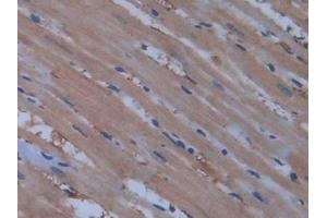 Detection of NOS2 in Rat Heart Tissue using Polyclonal Antibody to Nitric Oxide Synthase 2, Inducible (NOS2) (NOS2 抗体  (AA 518-694))