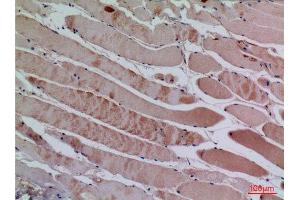 Immunohistochemistry (IHC) analysis of paraffin-embedded Human Muscle, antibody was diluted at 1:100. (CXCL13 抗体  (Internal Region))