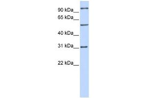 RAI14 antibody used at 1 ug/ml to detect target protein. (RAI14 抗体  (Middle Region))