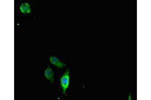 Immunofluorescent analysis of A549 cells using ABIN7147898 at dilution of 1:100 and Alexa Fluor 488-congugated AffiniPure Goat Anti-Rabbit IgG(H+L) (Claudin 2 抗体  (AA 30-230))