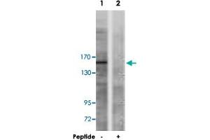 Western blot analysis of extracts from A-549 cells, using TP53BP1 polyclonal antibody . (TP53BP1 抗体)