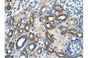 PKLR antibody was used for immunohistochemistry at a concentration of 4-8 ug/ml. (PKLR 抗体  (N-Term))