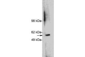 Western blot using  X1879P, rabbit polyclonal at 1 ug/ml on HeLa cell extract (20 ug/lane). (HDAC1 抗体)