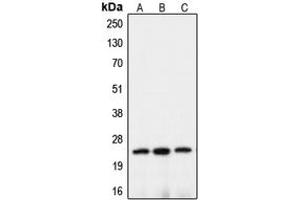 Western blot analysis of Claudin 10 expression in HEK293T (A), mouse brain (B), rat kidney (C) whole cell lysates. (CLDN10 抗体  (C-Term))