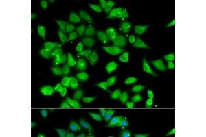 Immunofluorescence analysis of HeLa cells using NFATC3 Polyclonal Antibody (NFATC3 抗体)