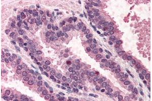 Human Prostate (formalin-fixed, paraffin-embedded) stained with POLK antibody ABIN291099 at 5 ug/ml followed by biotinylated anti-goat IgG secondary antibody ABIN481715, alkaline phosphatase-streptavidin and chromogen. (POLK 抗体  (AA 817-830))