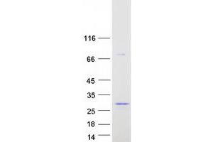 BPIFA1 Protein (Transcript Variant 1) (Myc-DYKDDDDK Tag)