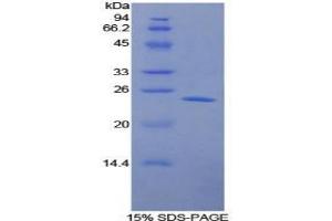 SDS-PAGE analysis of Human LMP7 Protein. (PSMB8 蛋白)