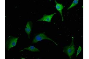 Immunofluorescence staining of U251 cells with ABIN7145119 at 1:50, counter-stained with DAPI. (AIDA 抗体  (AA 14-306))