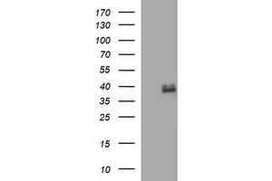 Image no. 1 for anti-Fatty Acid 2-Hydroxylase (FA2H) antibody (ABIN1500829) (FA2H 抗体)