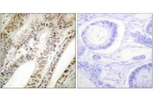 Immunohistochemistry analysis of paraffin-embedded human tonsil tissue, using PML Antibody. (PML 抗体  (AA 11-60))