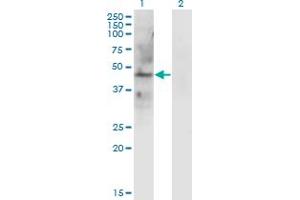 Western Blot analysis of LAMP2 expression in transfected 293T cell line by LAMP2 monoclonal antibody (M01), clone 2G10.