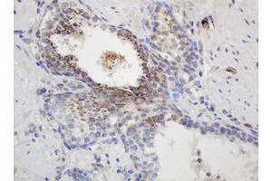 Image no. 2 for anti-Glyceraldehyde-3-Phosphate Dehydrogenase, Spermatogenic (GAPDHS) antibody (ABIN1498375) (GAPDHS 抗体)
