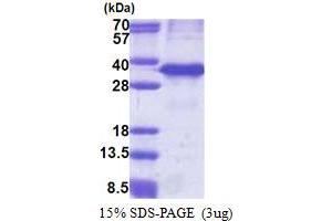 SDS-PAGE (SDS) image for Cathepsin Z (CTSZ) (AA 62-303) protein (His tag) (ABIN5853241) (Cathepsin Z Protein (CTSZ) (AA 62-303) (His tag))