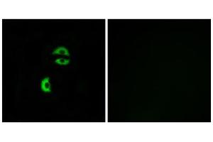 Immunofluorescence analysis of A549 cells, using LDLRAD3 antibody. (LDLRAD3 抗体  (Internal Region))
