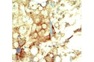 Immunohistochemistry (IHC) image for anti-Ret Proto-Oncogene (RET) (AA 1012-1042) antibody (ABIN3032460)