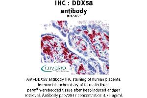 Image no. 2 for anti-DEAD (Asp-Glu-Ala-Asp) Box Polypeptide 58 (DDX58) antibody (ABIN1733572)