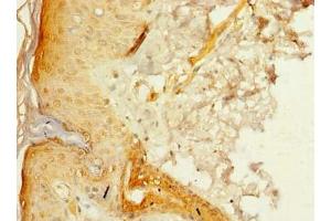 Immunohistochemistry of paraffin-embedded human skin tissue using ABIN7175005 at dilution of 1:100 (MRPL46 抗体  (AA 28-153))