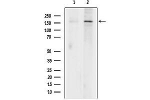 Western blot analysis of lysates from DU145 cells, using KDM5C / Jarid1C / SMCX Antibody.