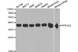 Western blot analysis of extracts of various cell lines, using PPP1CA antibody (ABIN5971210) at 1/1000 dilution. (PPP1CA 抗体)