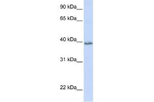 Tetraspanin 10 antibody used at 1 ug/ml to detect target protein. (TSPAN10 抗体  (N-Term))