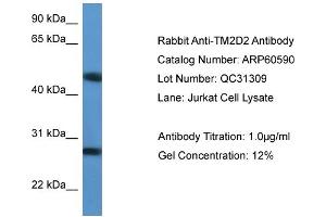 WB Suggested Anti-TM2D2  Antibody Titration: 0. (TM2D2 抗体  (Middle Region))