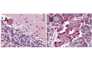 anti-LGR4 monoclonal antibody was used diluted to 5 ? (LGR4 抗体  (Internal Region))