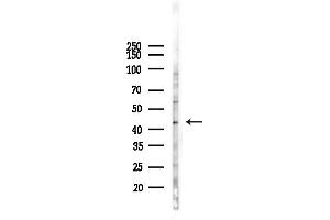 Western blot analysis of lysates from COLO205 cells(UV,30 min treatment), using GPR34 Antibody at 1/1000 dilution.