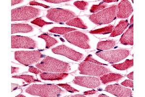 Anti-PYGM / Phosphorylase b antibody IHC of human skeletal muscle. (PYGM 抗体  (Internal Region))