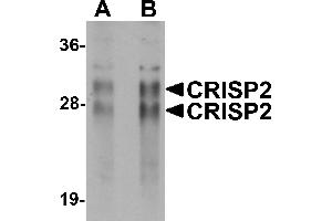 Western Blotting (WB) image for anti-Cysteine-Rich Secretory Protein 2 (CRISP2) (N-Term) antibody (ABIN1031327) (CRISP2 抗体  (N-Term))