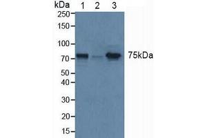 Western blot analysis of (1) Human Liver Tissue, (2) Human HeLa cells and (3) Mouse Uterus Tissue. (GBA 抗体  (AA 117-214))